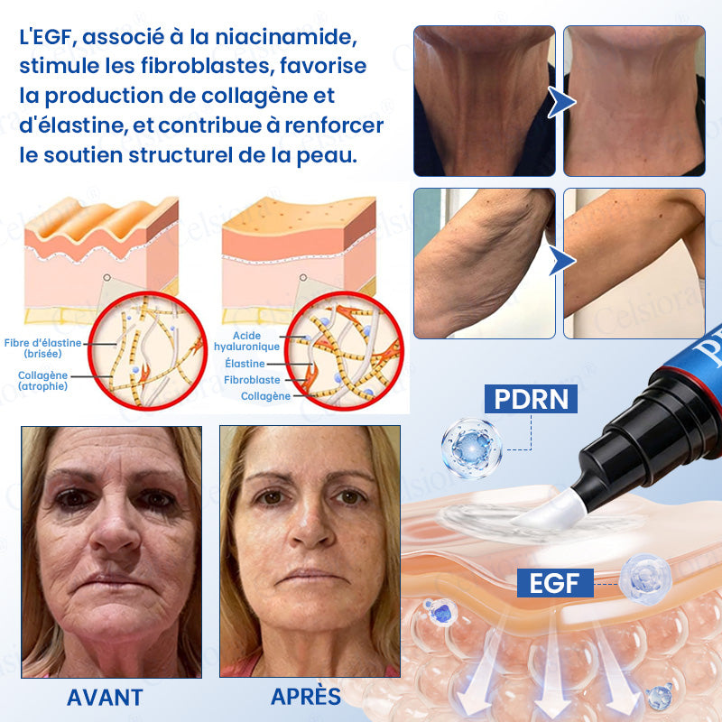 🪁💞Celsiora® PDRN Soin Anti-Rides – Crème Liftante et Raffermissante