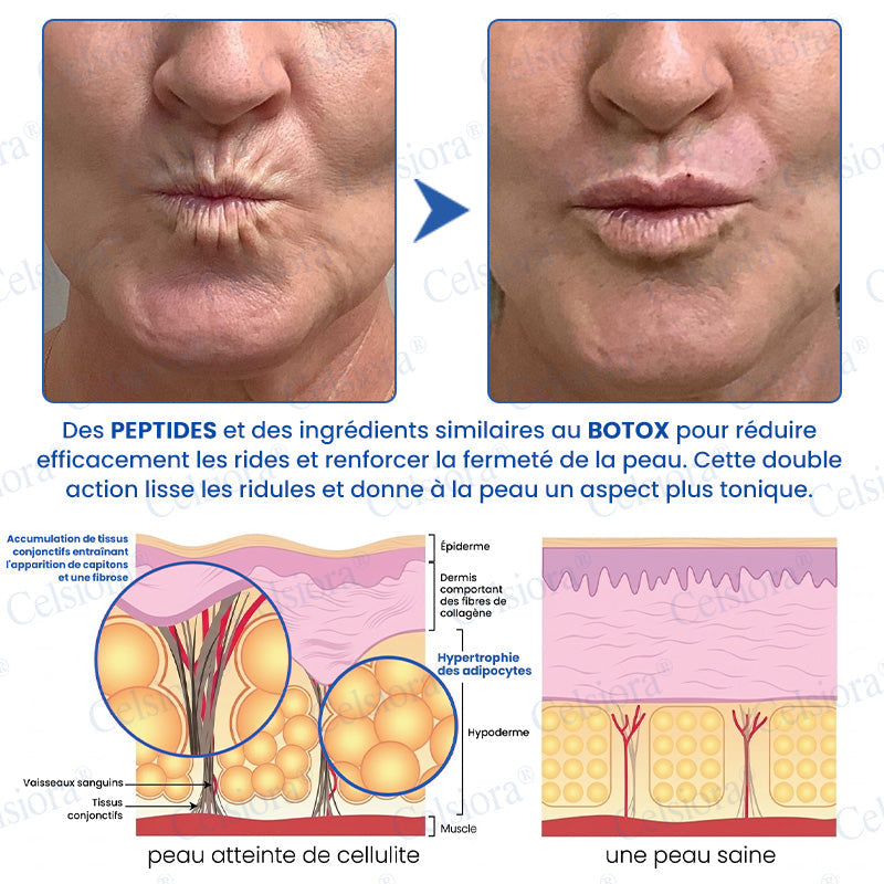 🪁💞Celsiora® PDRN Soin Anti-Rides – Crème Liftante et Raffermissante