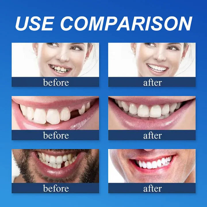 🌎Ends Today: 70% OFF! ⏰specialcoderes™ Medical Full Denture with Strong Suctiond🦷Obtain Dental Association Certification