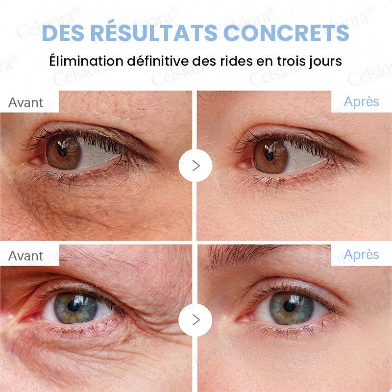 🪁💞Celsiora® PDRN Soin Anti-Rides – Crème Liftante et Raffermissante