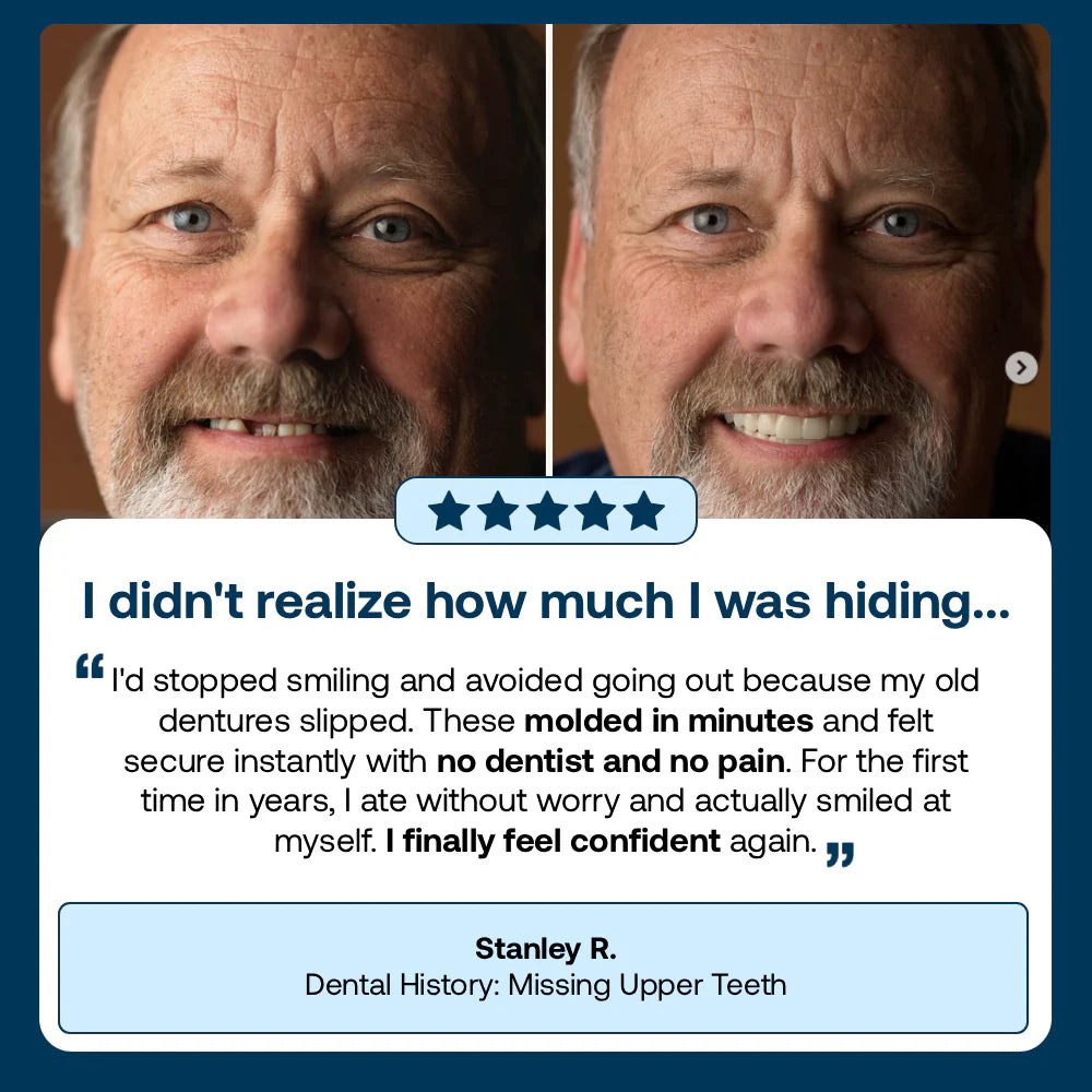 🌎Ends Today: 70% OFF! ⏰specialcoderes™ Medical Full Denture with Strong Suctiond🦷Obtain Dental Association Certification