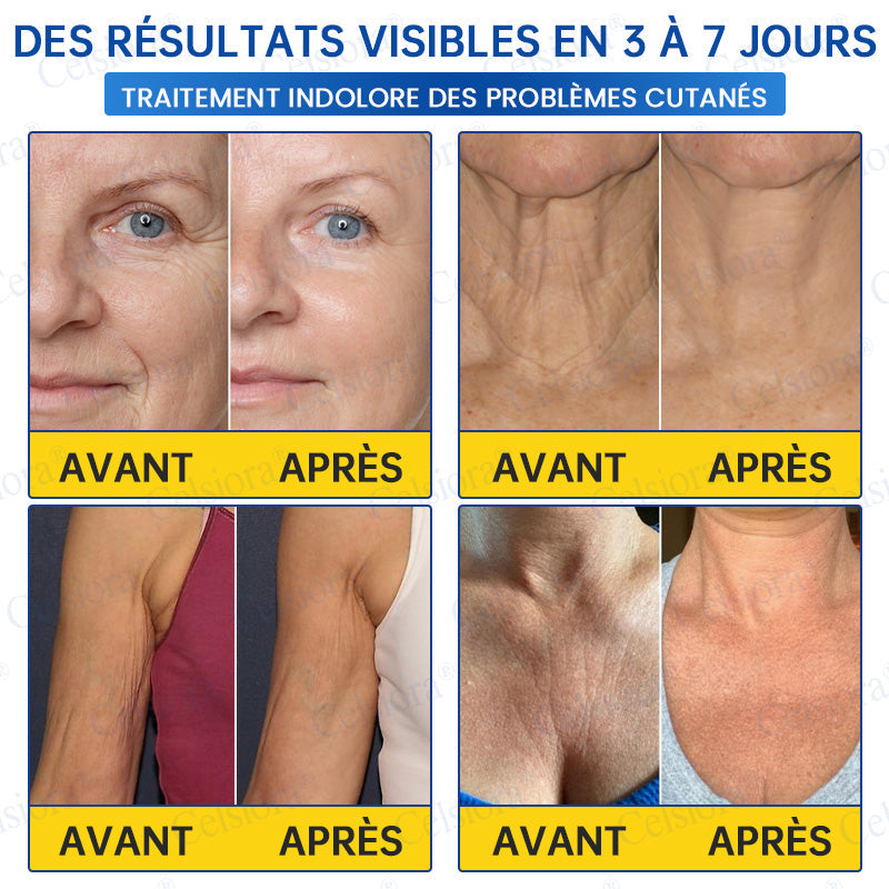 🪁💞Celsiora® PDRN Soin Anti-Rides – Crème Liftante et Raffermissante