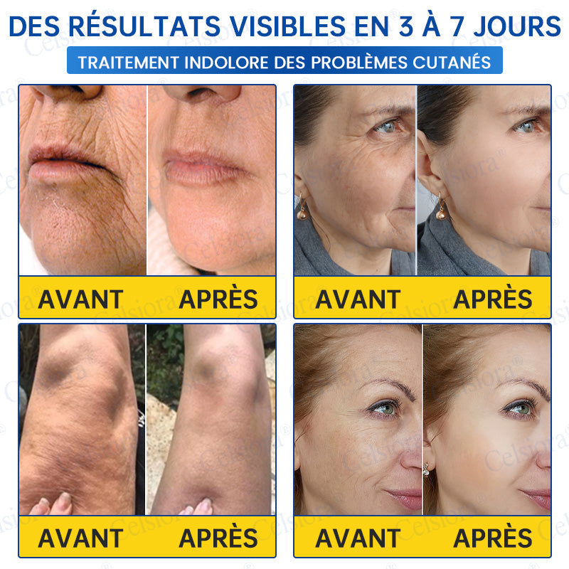 🪁💞Celsiora® PDRN Soin Anti-Rides – Crème Liftante et Raffermissante