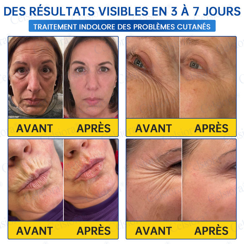 🪁💞Celsiora® PDRN Soin Anti-Rides – Crème Liftante et Raffermissante